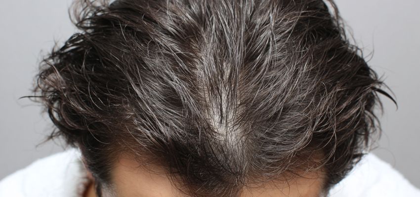 The scalp condition is having a great impact on your hair look and health.